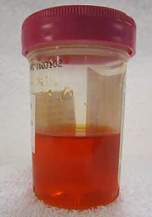 Phenazopyridine urine color