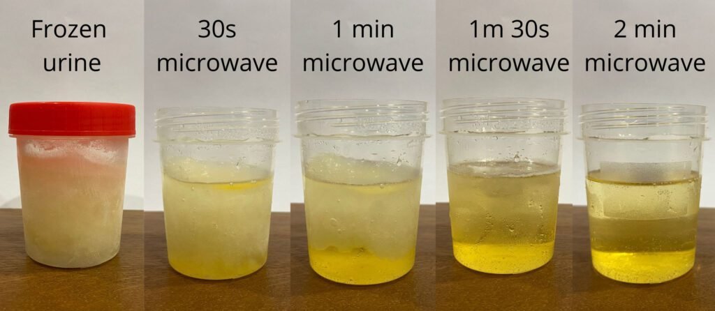 frozen urine in microwave