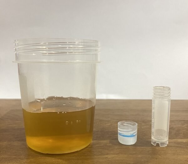 sub solution synthetic urine dissolved in water